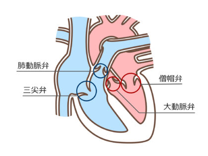 ⼼臓弁膜症について