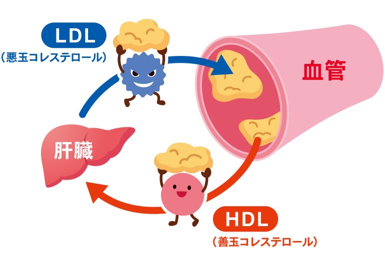 善・悪玉コレステロール